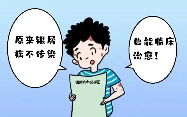 牛皮癣会传染给他人吗